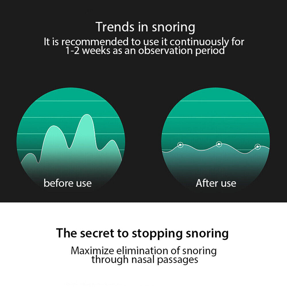 Anti Snoring