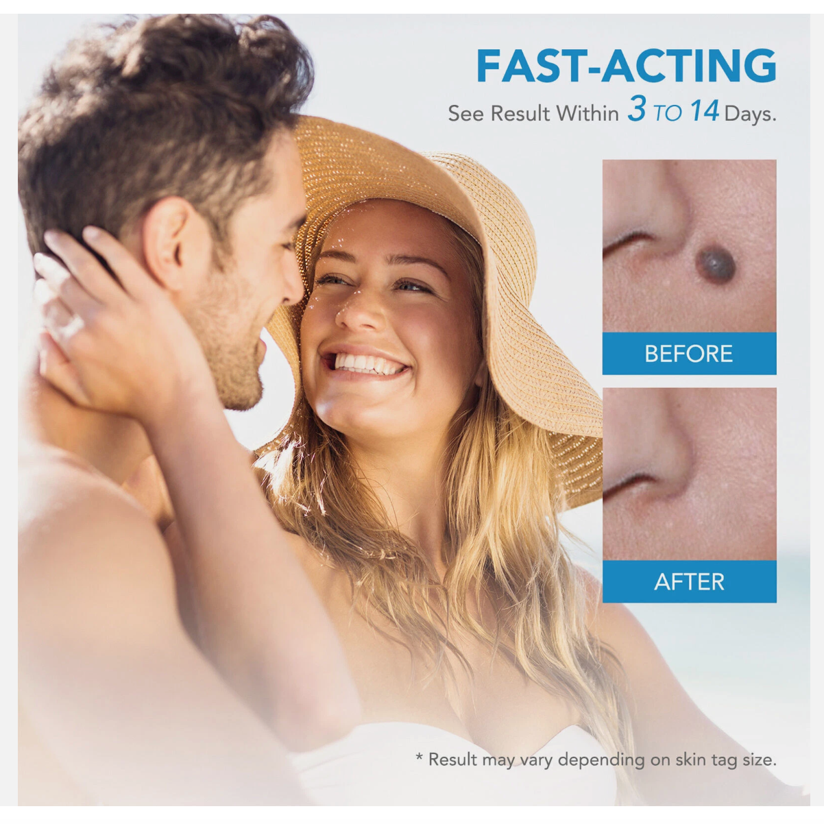 Painless Skin Tag Mole Wart Removal Kit, Body Auto SKIN TAG Bands Remover Safe