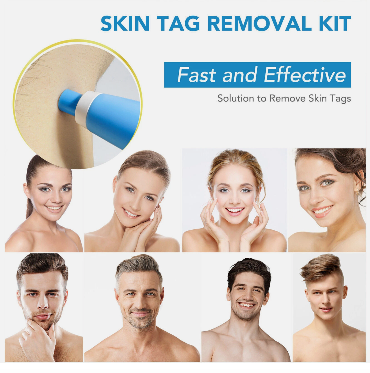 Painless Skin Tag Mole Wart Removal Kit, Body Auto SKIN TAG Bands Remover Safe