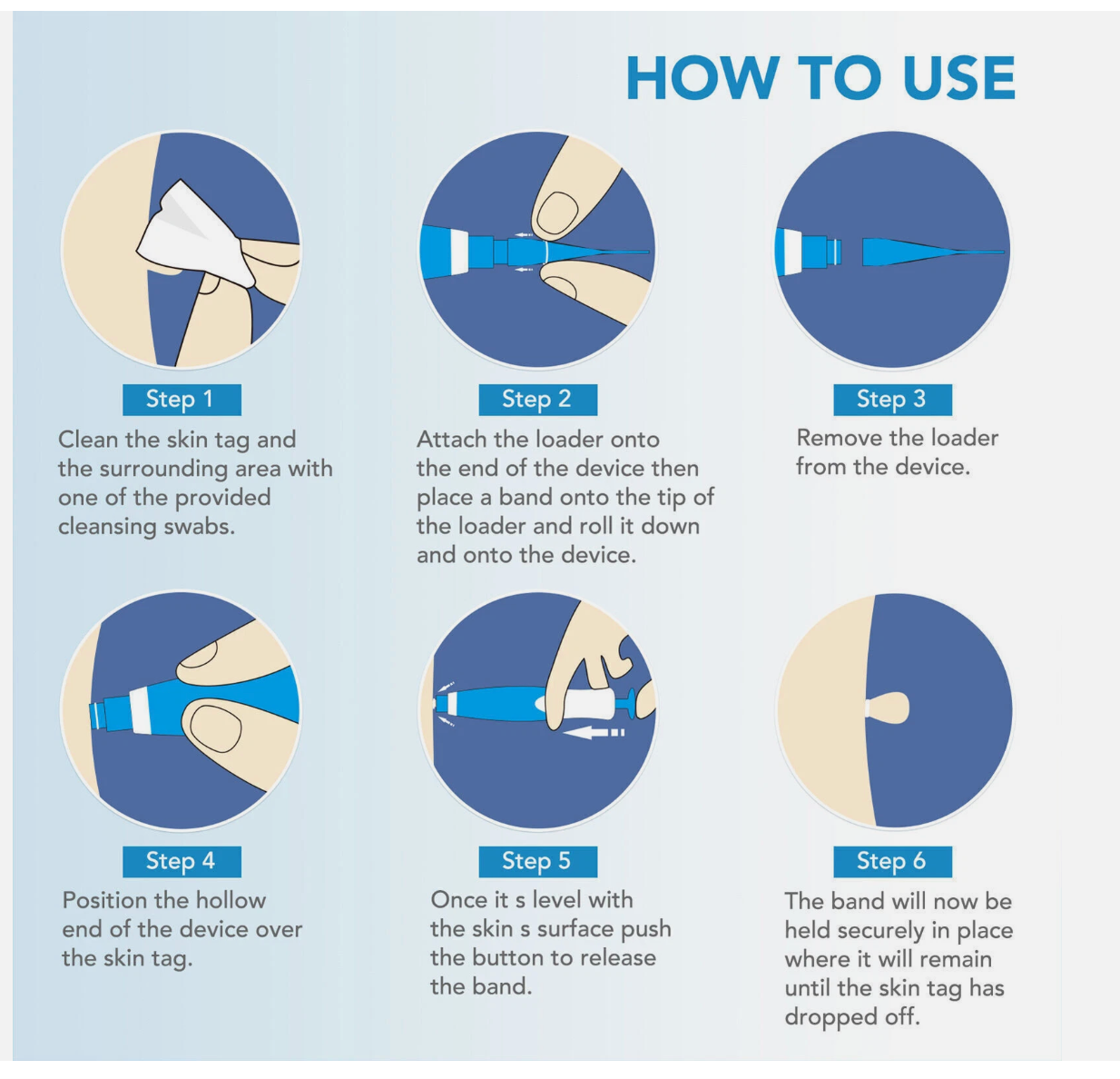 Painless Skin Tag Mole Wart Removal Kit, Body Auto SKIN TAG Bands Remover Safe