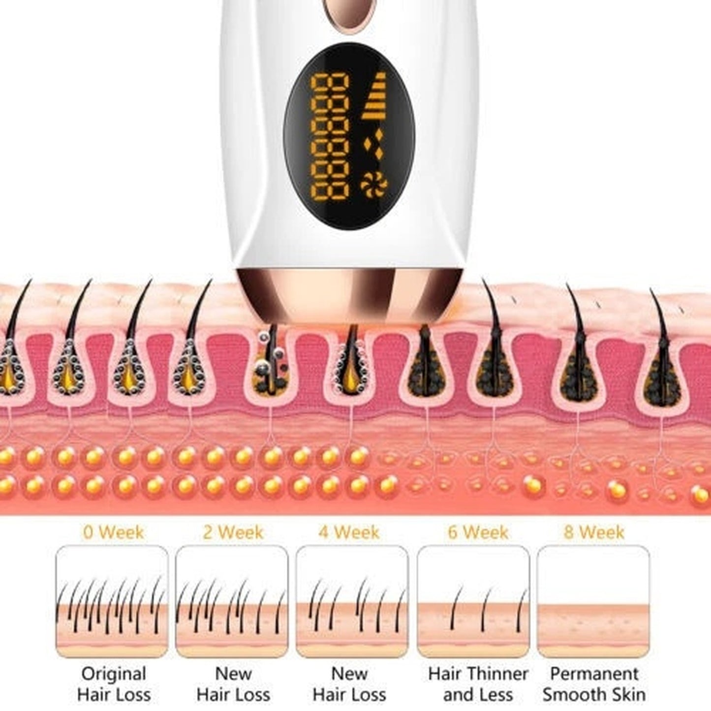 IPL Laser Hair Removal Device | 990,000 Flashes | 5 Levels | LCD Display | Men & Women