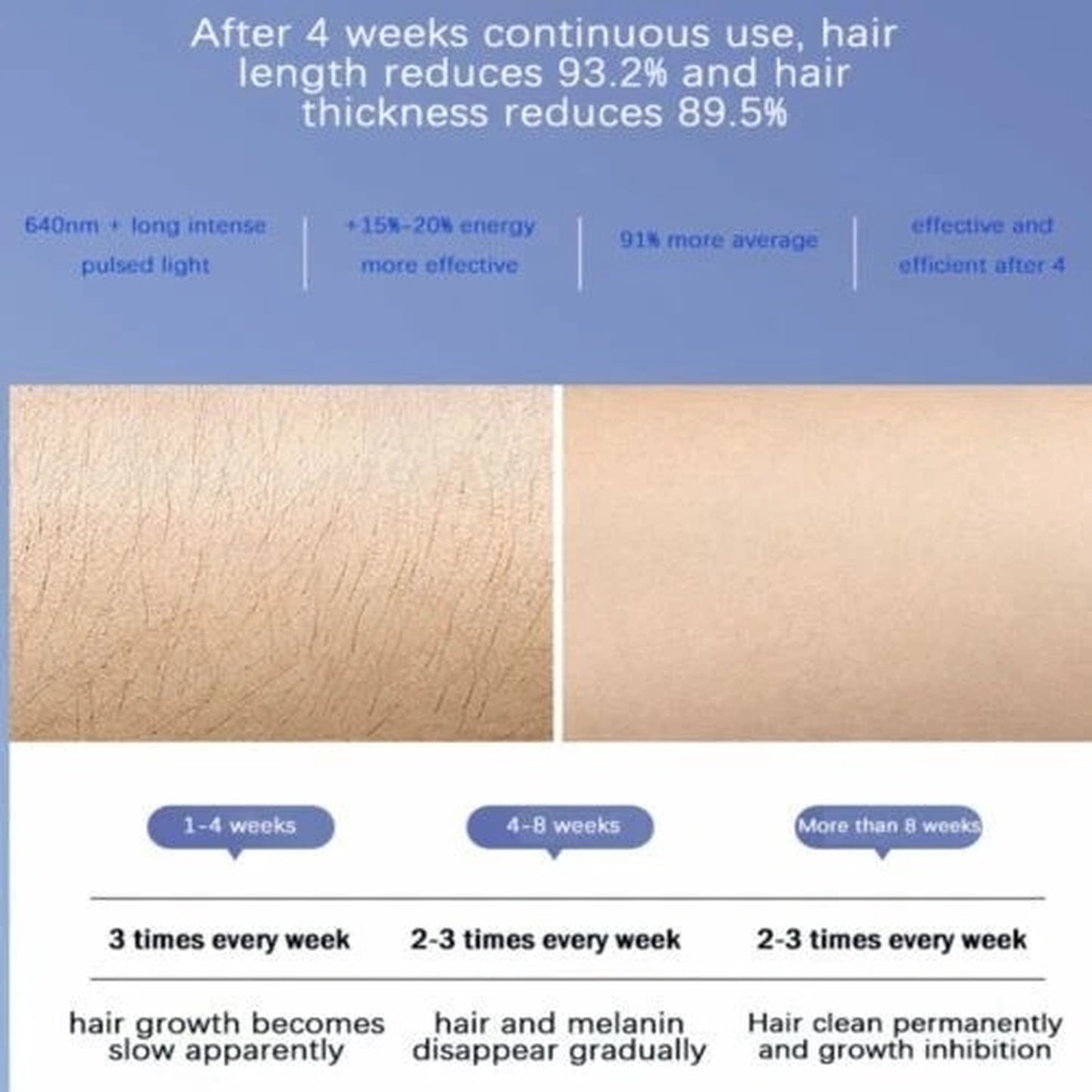 IPL Laser Hair Removal Device | 990,000 Flashes | 5 Levels | LCD Display | Men & Women