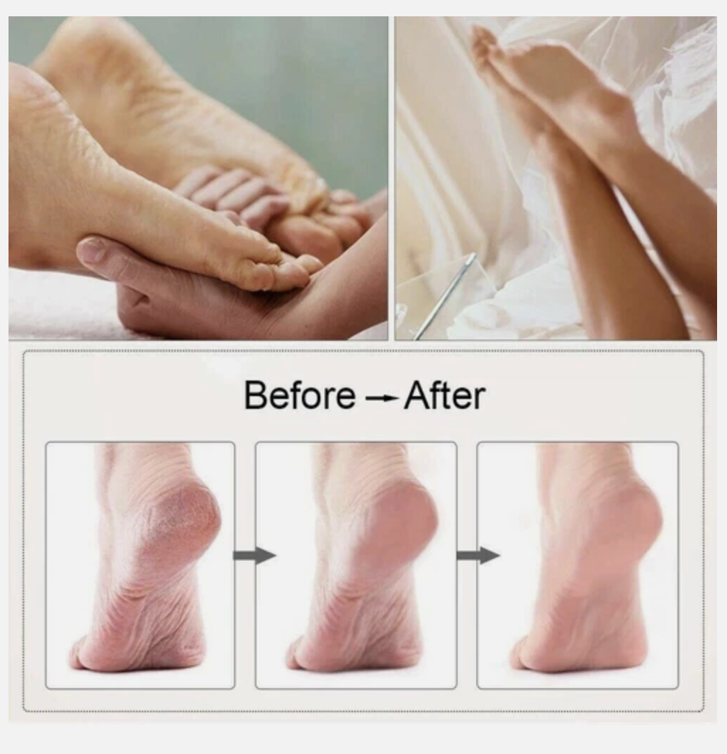Electric Foot Grinder Care Pedicure Foot File Hard Dead Skin Callus Remover