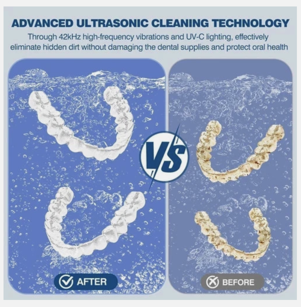 Ultrasonic Retainer Cleaner UV-Dental Pod Denture Aligner Mouth Guard Cleaning